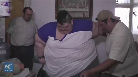 Worlds Most Obese Man To Receive Weight Loss Treatment In Mexico Youtube