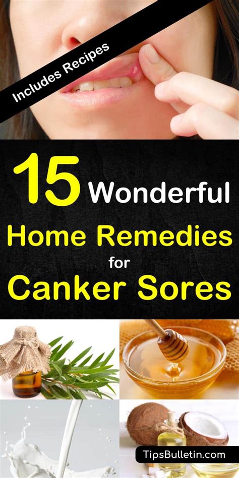 15 Canker Sore Relief Remedies That Work