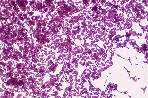 Bacillus Gram Positive Stain Under The Microscope View Bacillus Is