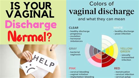 vaginal discharge types treatment white vaginal discharge explained sexiz pix
