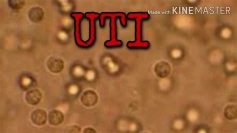 Uti Or Urinary Tract Infection Youtube