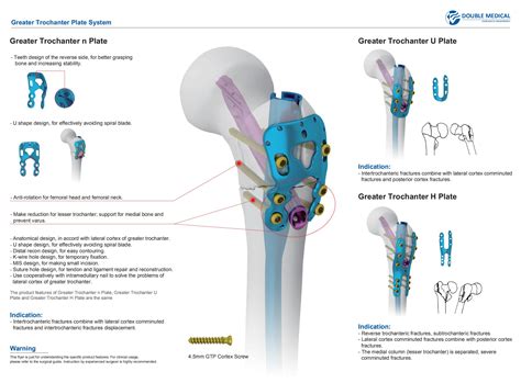 Greater Trochanter U Platemedical Device Manufacturers Double Medical