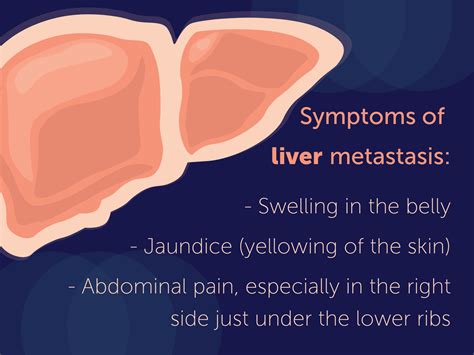 What Are The Symptoms Of Metastatic Breast Cancer