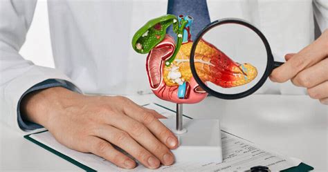 Interactive Case Study Recognition And Management Of Pancreatogenic
