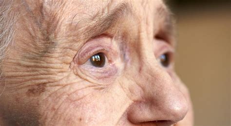 Is dementia reversible or curable? - SeniorNews