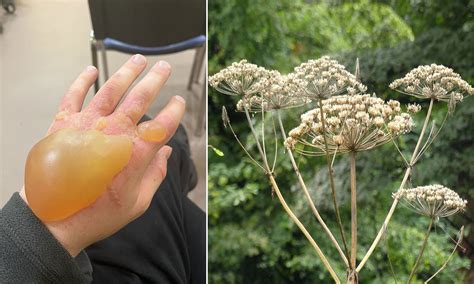 Do You Know Britains Most Dangerous Plant How To Spot Giant Hogweed