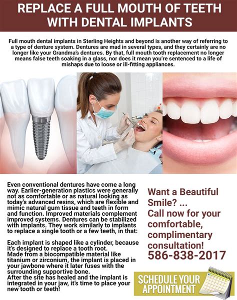 Can All Teeth Be Replaced With Full Mouth Dental Implants Read More