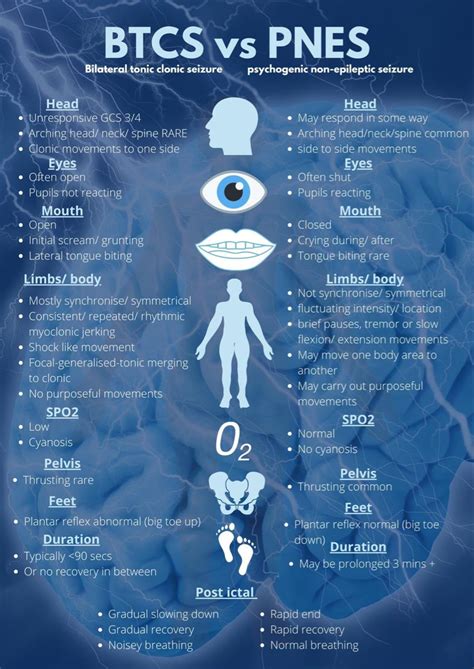 Pin By Kathleen Davis On Nursing In Seizures Nursing Seizures Non Epileptic Neurology