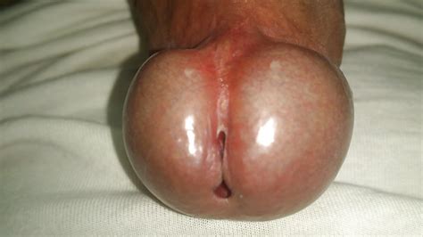 Thick Fat Cock Perfect Swollen Head 15 Pics Xhamster
