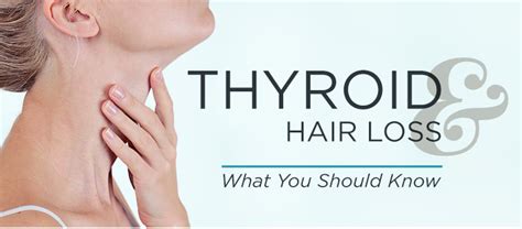 Understanding Hypothyroidism Hair Loss Toppik Hair Blog