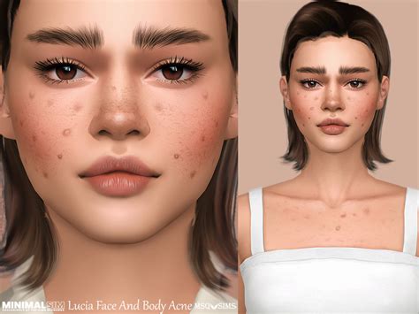 The Sims Resource Minimalsim Lucia Face And Body Acne