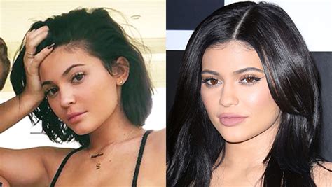 Kylie Jenner’s Lip Fillers Removed She Reveals New Look Hollywood Life