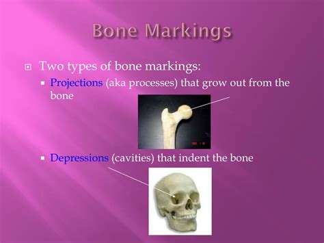Ppt Bones Powerpoint Presentation Free Download Id6703836