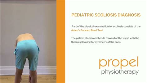 Adams Forward Bend Test Signs Of Scoliosis In Kids Propel