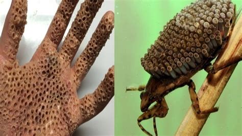 Trypophobia Images Insect