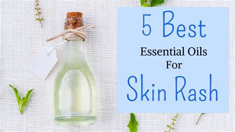 5 Best Essential Oils For Itchy Skin Rash That Instantly Relieves