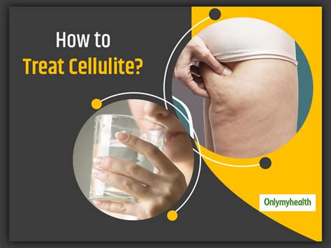 How To Get Rid Of Cellulite On Thighs Onlymyhealth