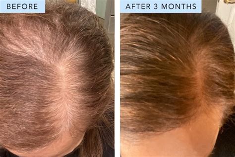 Women Over 50 Can Get Thicker Fuller Hair Without Using Drugs Or