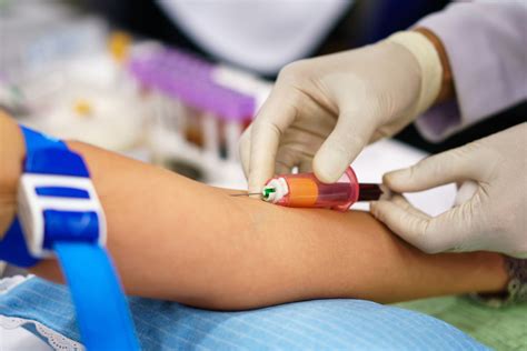 Blood Tests Ordered By Rheumatologists