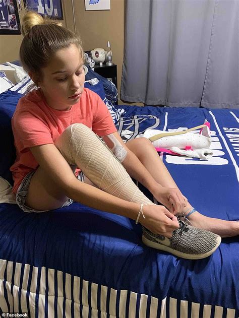 Girl 12 Is Walking Again After Flesh Eating Bacteria Daily Mail Online