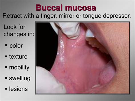 Buccal Mucosa Anatomy