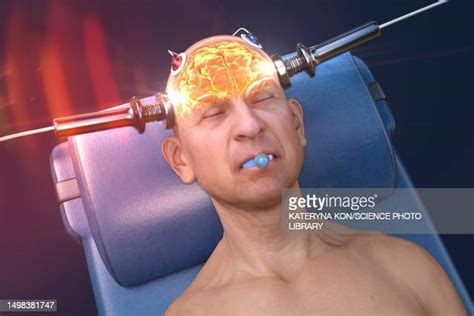 Electric Shock Therapy Photos And Premium High Res Pictures Getty Images