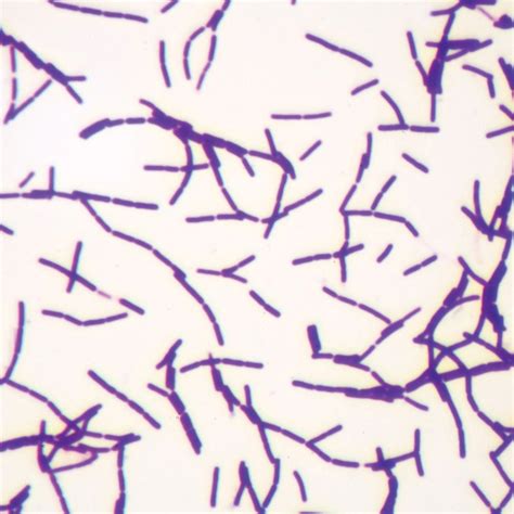 Gram Stain Microscope Slide Mixed Gram Positive And Gram Negative