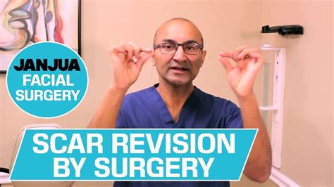 Scar Revision By Surgery 59 Plus 1 Dr Tanveer Janjua Youtube