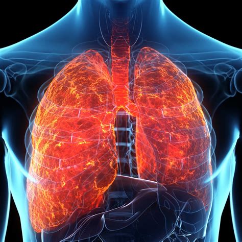 Chronic Obstructive Pulmonary Disease Copd Concept St