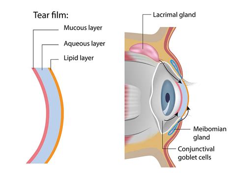 Meibomian Gland Dysfunction Mgd One Of Contributing Factors To Dry