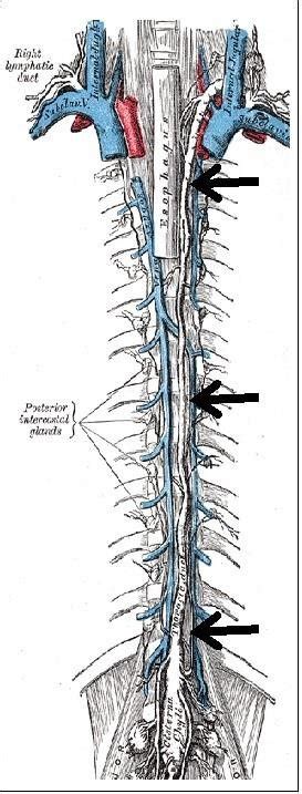 Thoracic Duct Anatomy Black Arrows Download Scientific Diagram