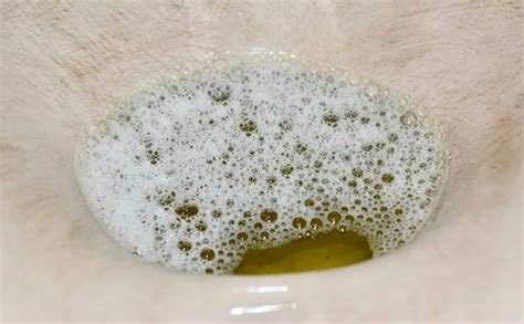 What Does It Mean When You Have Foamy Urine