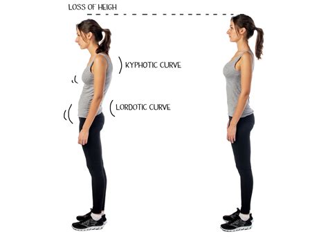 Benefits Of Having Good Posture Holistic Medical Clinic