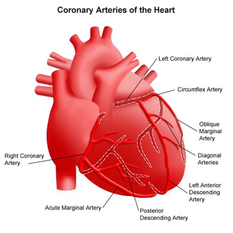 Coronary Artery Disease Stanford Health Care