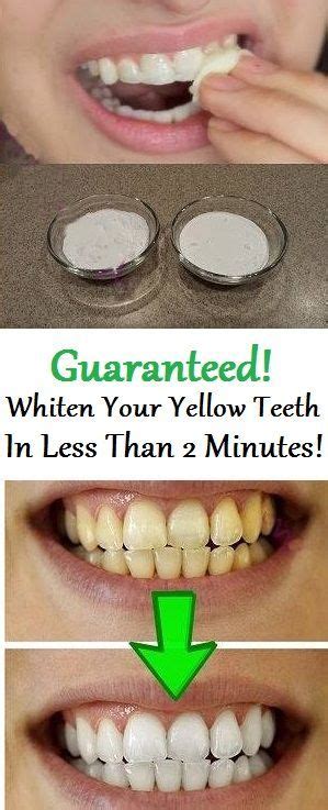 Guaranteed Whiten Your Yellow Teeth In Less Than 2 Minutes