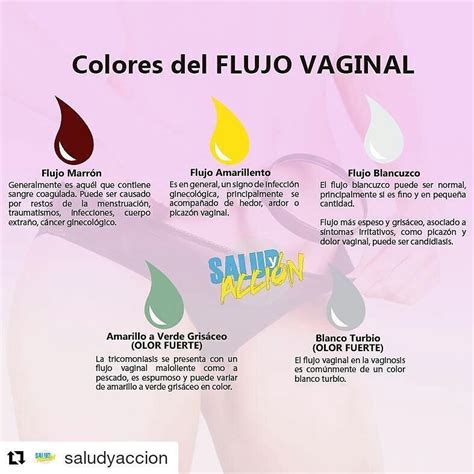 Es Inutil Publicidad Ordenar Color Del Flujo Vaginal Cerdito Contenido