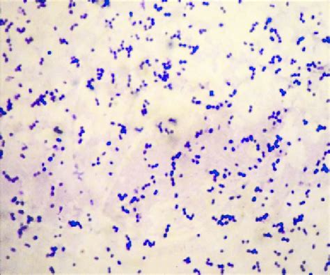Bacteria Cells Gram Positive Cocci In Chain Medical Background The