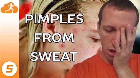 Pimples From Sweat While Working Out Youtube