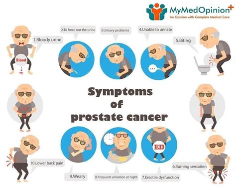 What Are The Signs And Symptoms Of Prostate Cancer Brittany Roy S Blog