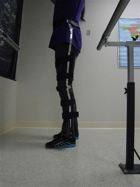 Knee Ankle Foot Orthotics Kafo Align Clinic Wi