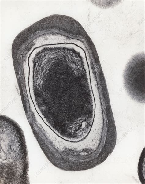 Tem Of Bacillus Subtilis Bacterium Endospore Stock Image B2200166