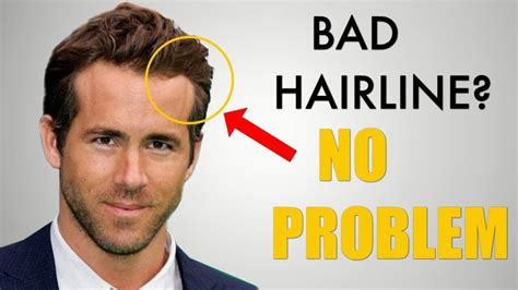 5 Awesome Hairstyles For Widows Peak Receding Hairline Youtube