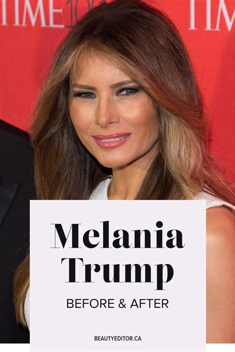 2.6m likes · 234,493 talking about this. Melania Trump, Before and After - Beautyeditor