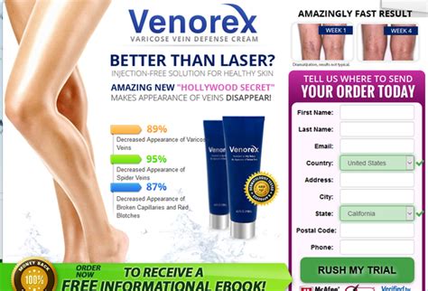 Best Cream To Get Rid Of Spider Veins Venorex Varicose Vein