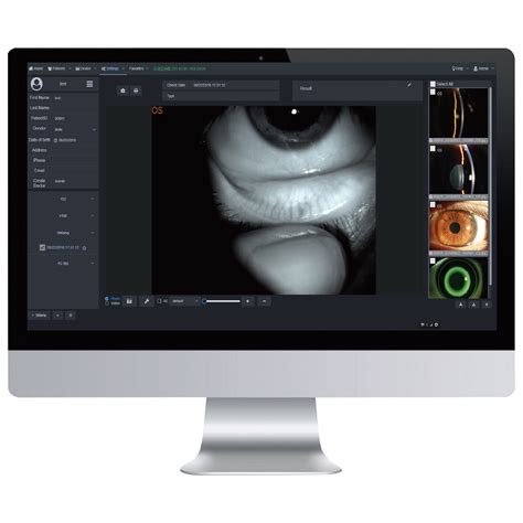 Mediworks S390l Firefly Wdr Digital Anterior Segment And Meibography