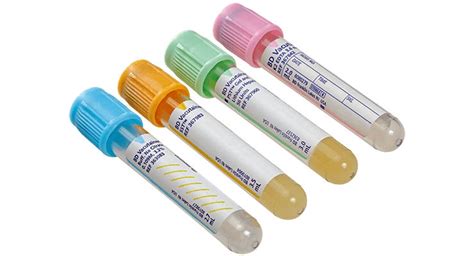 Bd Recalls Vacutainer Edta Blood Collection Tubes Over Chemical Sexiezpix Web Porn