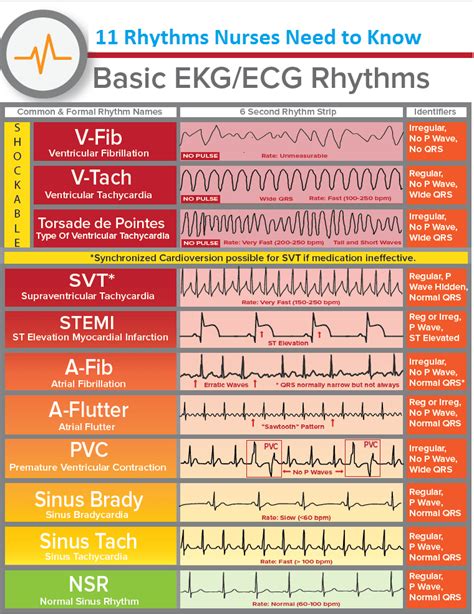 Ekg Interpretation Cheat Sheet EKG ECG Cheat Sheet Nursing Tips