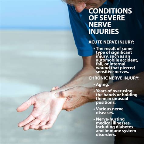 Nerves In The Hand Florida Orthopaedic Institute