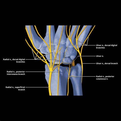 Radial Nerve Radiology Key