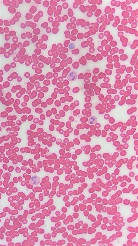 Human Blood Histology Are The Purple Blobs Monocytes And Lymphocytes